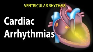 Cardiac Arrhythmias Animation [upl. by Quintus]