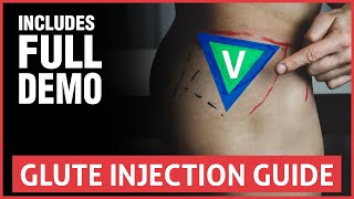 All You Need To Know About Joint Injections [upl. by Elesig]