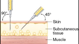 Subcutaneous Injection Demonstration [upl. by Dmitri420]