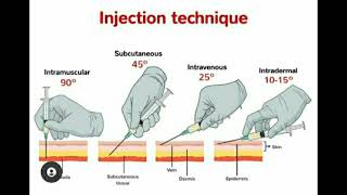 How To Do A Glute Injection  Full Guide And Demo [upl. by Auqinal]