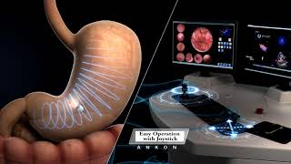 Capsule Endoscopy Animation  ANKON NaviCam [upl. by Maleeny]