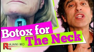 BOTOX for THE NECK  Neck Lift [upl. by Aysahc]